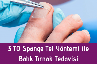 3-to-spange-tel-tedavisi