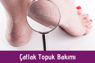 catlak-topuk-bakimi